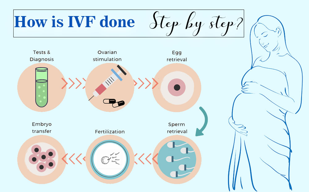 Ivf Treatment Step By Step Process In The Best Ivf Fertility Centres